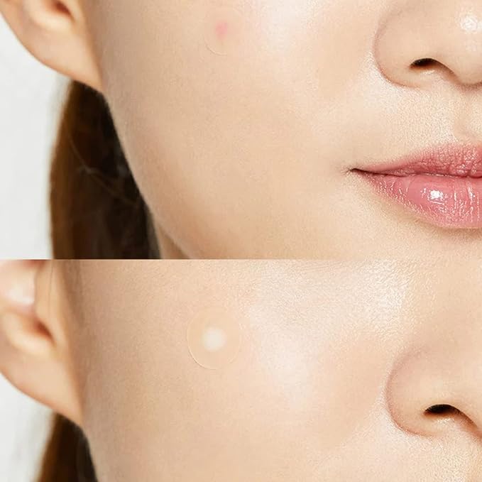 COSRX Acne Pimple Master Patches Patch