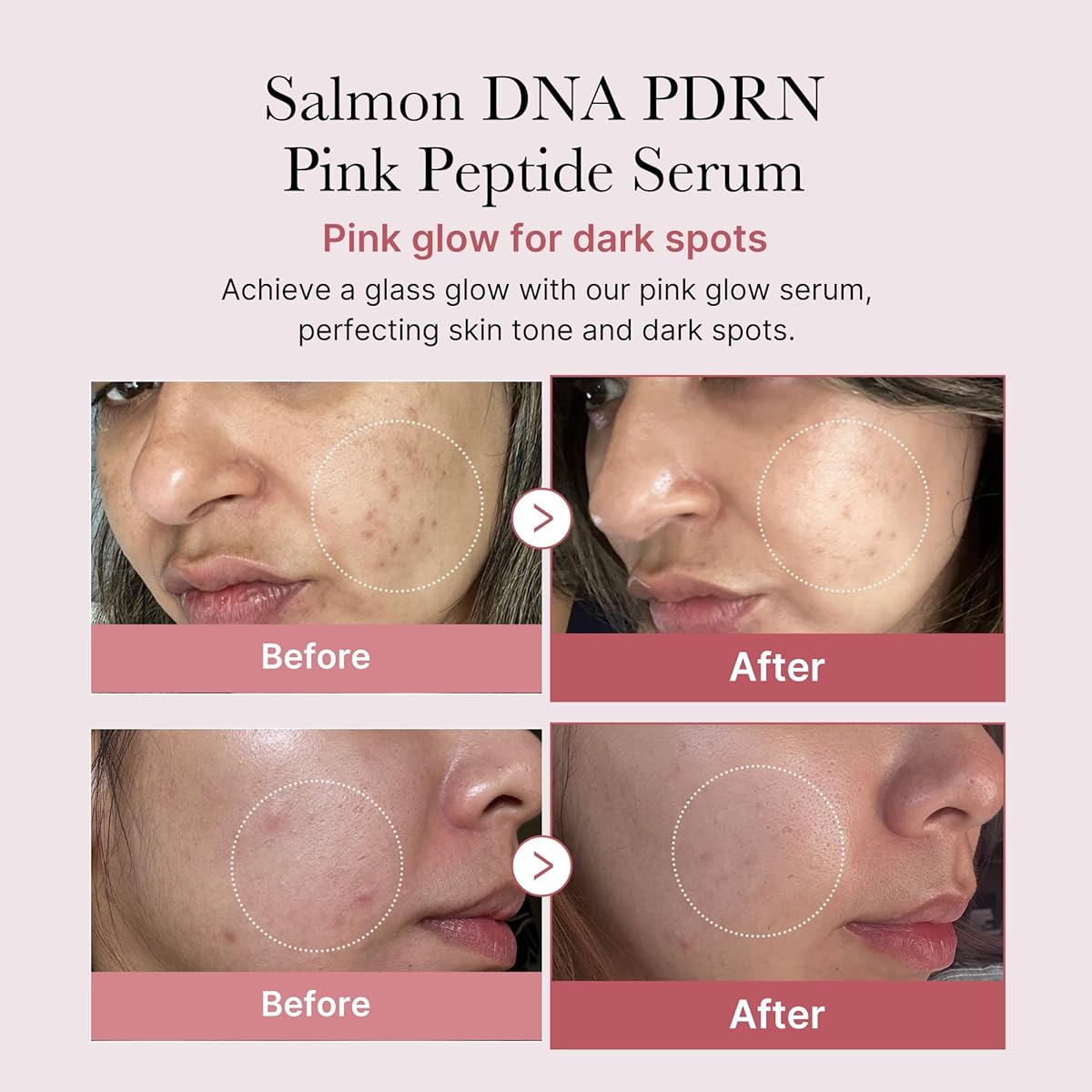 Medicube Salmon DNA PDRN Pink Peptide Serum, Pink glow serum, Peptide, Niacinamide, Hydrating & Mois
