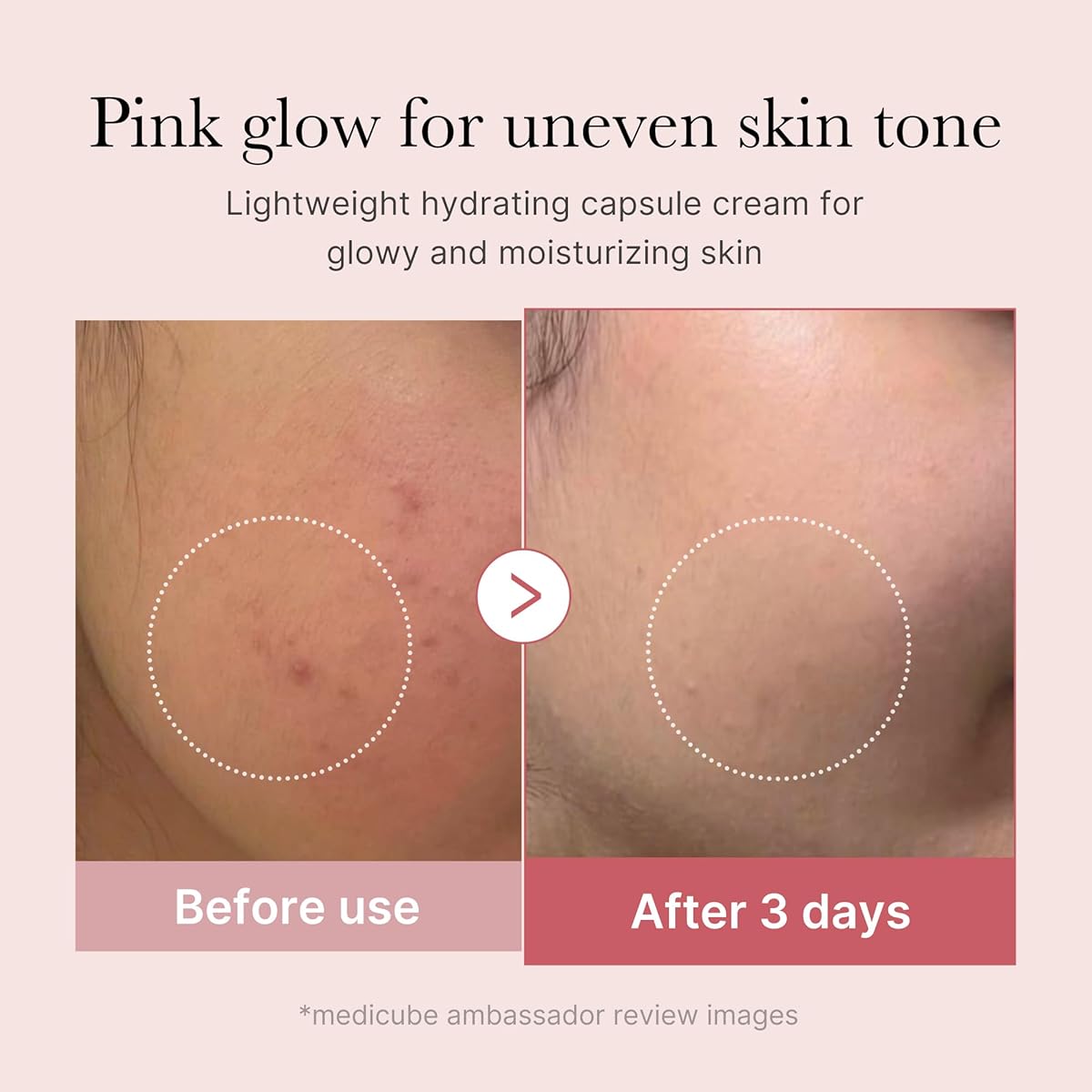 Medicube Salmon DNA PDRN Pink Peptide Serum, Pink glow serum, Peptide, Niacinamide, Hydrating & Mois